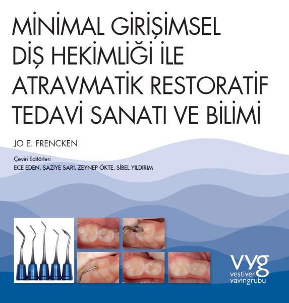 Minimal Girişimsel Diş Hekimliği ile Atravmatik Restoratif Tedavi Sanatı ve Bilimi