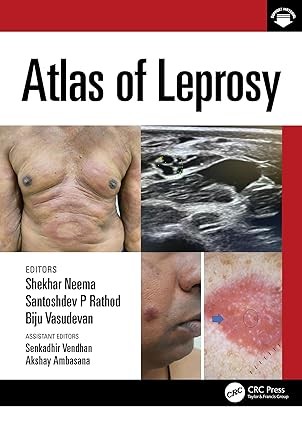 Atlas of Leprosy