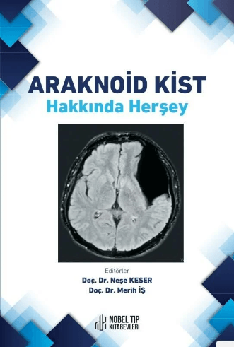 Araknoid Kist Hakkında Herşey