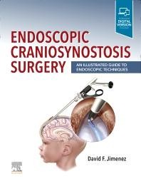 Endoscopic Craniosynostosis Surgery