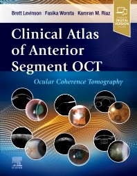 Clinical Atlas of Anterior Segment OCT: Ocular Coherence Tomography