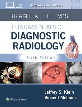 Brant & Helm's Fundamentals of Diagnostic Radiology: Print + eBook with Multimedia 6, Edition