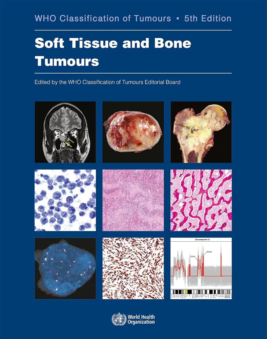 Soft Tissue and Bone Tumours WHO Classification of Tumours, 5th