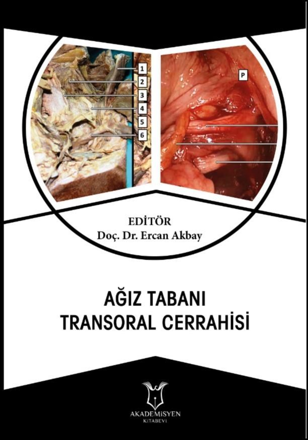 Ağız Tabanı Transoral Cerrahisi