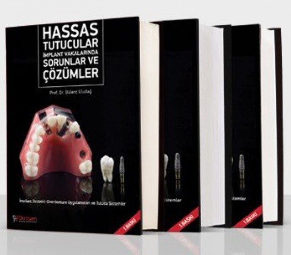 Hassas Tutucular İmplant Vakalarında Sorunlar ve Çözümler