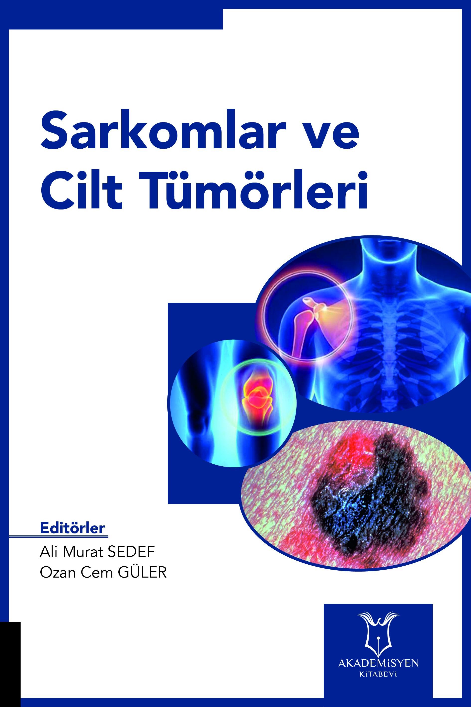 Sarkomlar ve Cilt Tümörleri