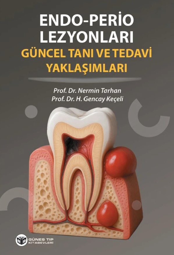 Endo - Perio Lezyonları Güncel Tanı ve Tedavi Yaklaşımları