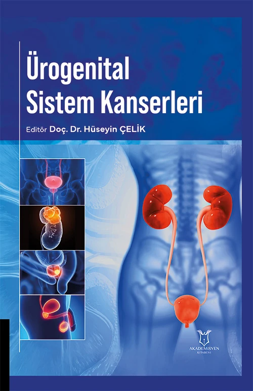 Ürogenital Sistem Kanserleri
