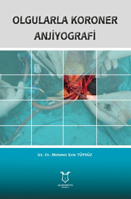 Olgularla Koroner Anjiyografi