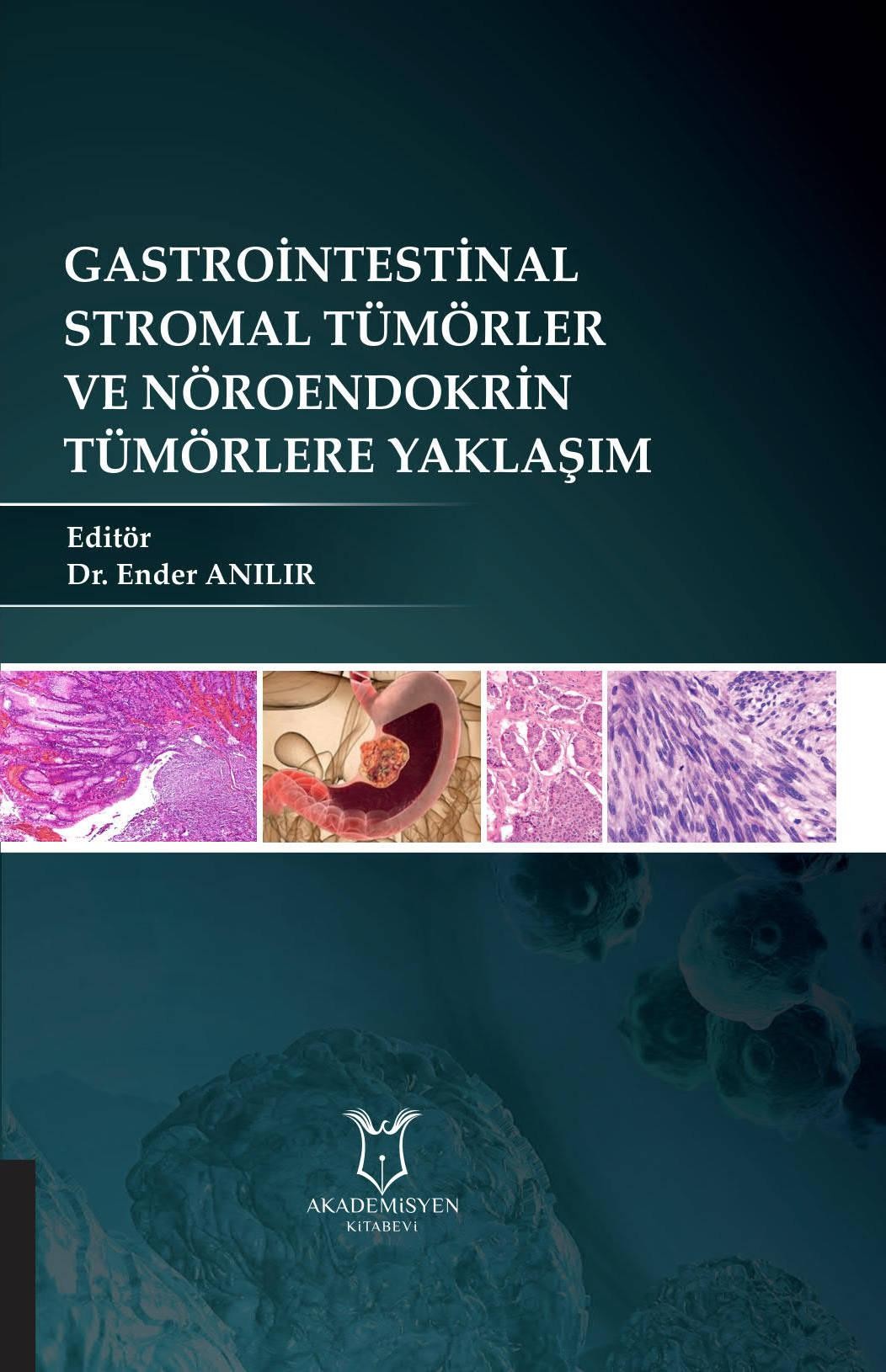Gastrointestinal Stromal Tümörler ve Nöroendokrin Tümörlere Yaklaşım