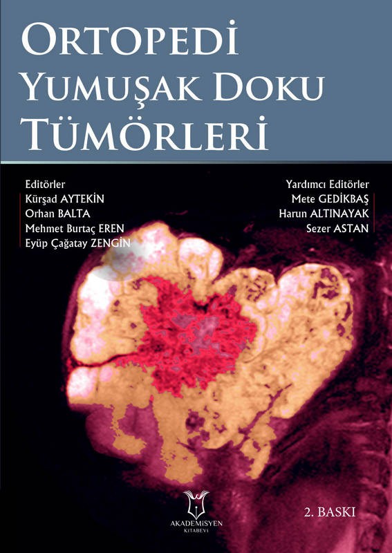 Ortopedi Yumuşak Doku Tümörleri (2. Baskı)  (E-Kitap)