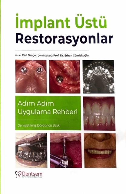 İmplant Üstü Restorasyonlar Adım Adım Uygulama Rehberi