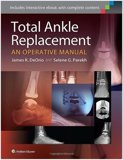 Total Ankle Replacement: An Operative Manual First Edition