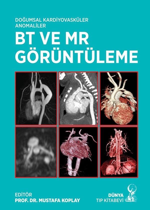 Doğumsal Kardiyovasküler Anomaliler BT ve MR Görüntüleme