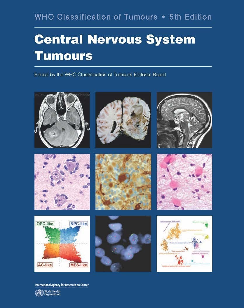 Central Nervous System Tumours WHO Classification of Tumours, 5th