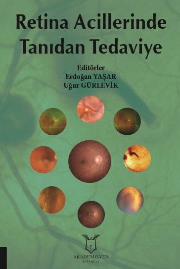 Retina Acillerinde Tanıdan Tedaviye