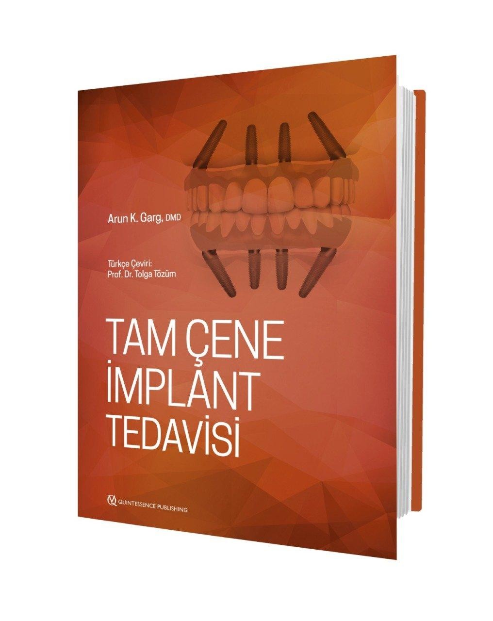 Tam Çene İmplant Tedavisi