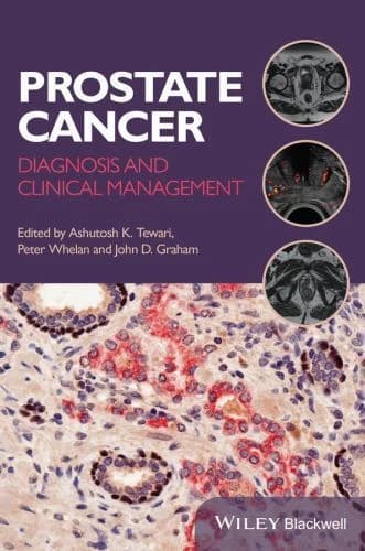 Prostate Cancer : Diagnosis and Clinical Management - 9781118347355