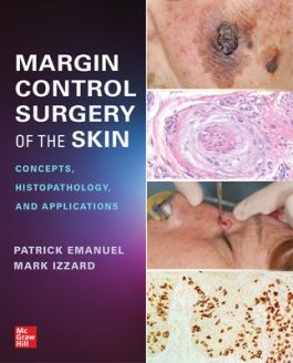 Margin Control Surgery of the Skin: Concepts, Histopathology, and Applications
