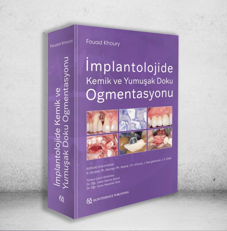 İmplantolojide Kemik ve Yumuşak Doku Ogmentasyonu