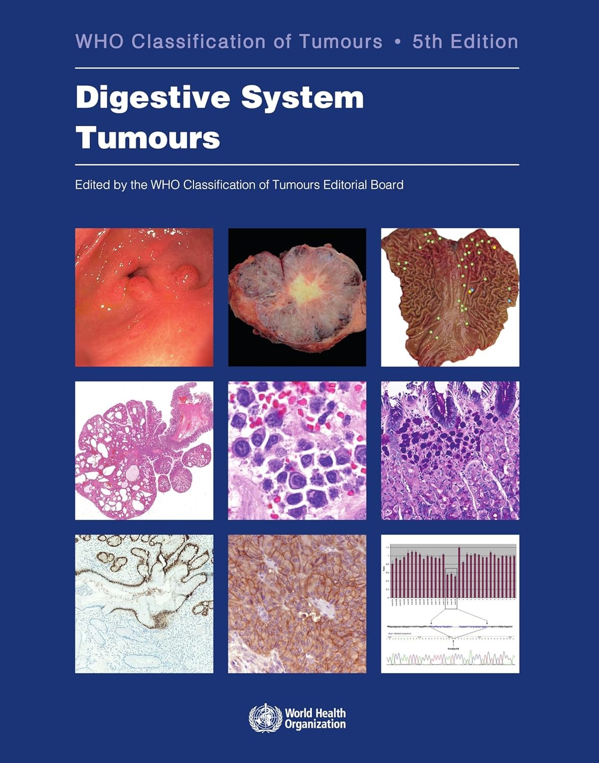 Digestive System Tumours WHO Classification of Tumours, 5th