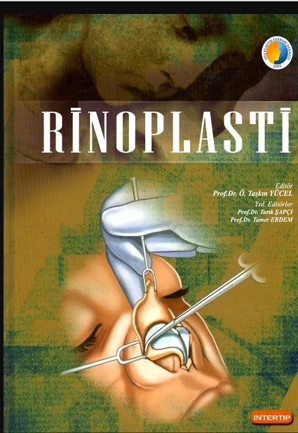 Rinoplasti