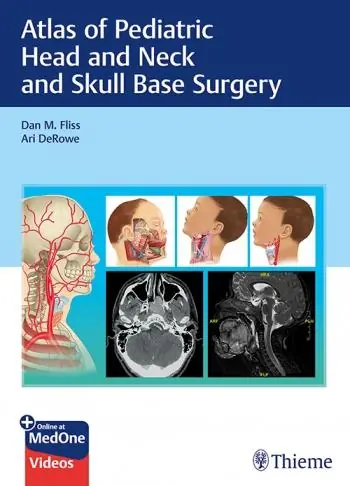 Atlas of Pediatric Head and Neck and Skull Base Surgery - 9783132414273