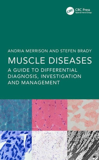 Muscle Diseases A Guide to Differential Diagnosis, Investigation and Management