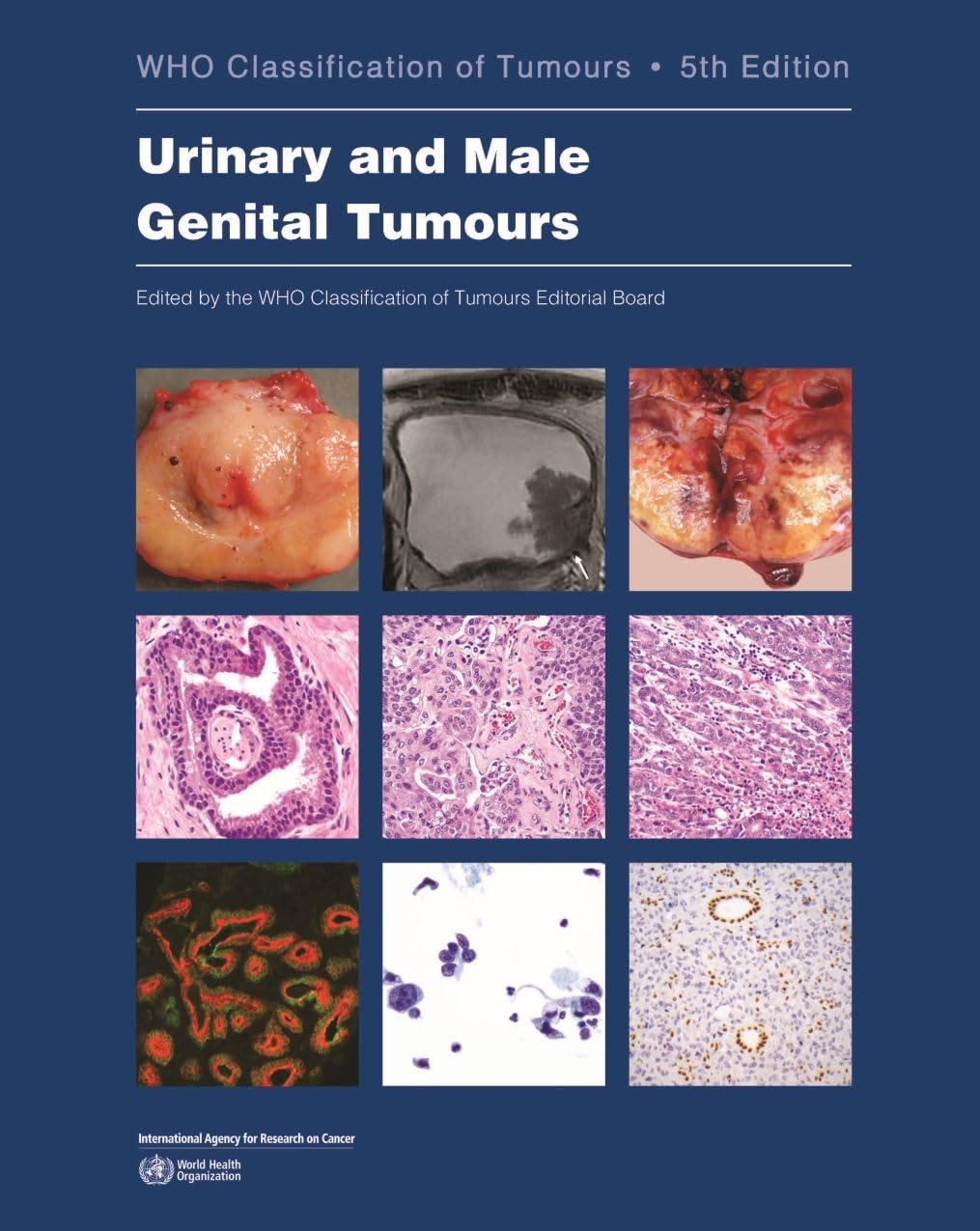 Urinary and Male Genital Tumours WHO Classification of Tumours, 5th
