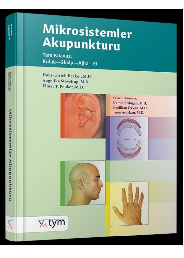 Mikrosistemler Akupunkturu