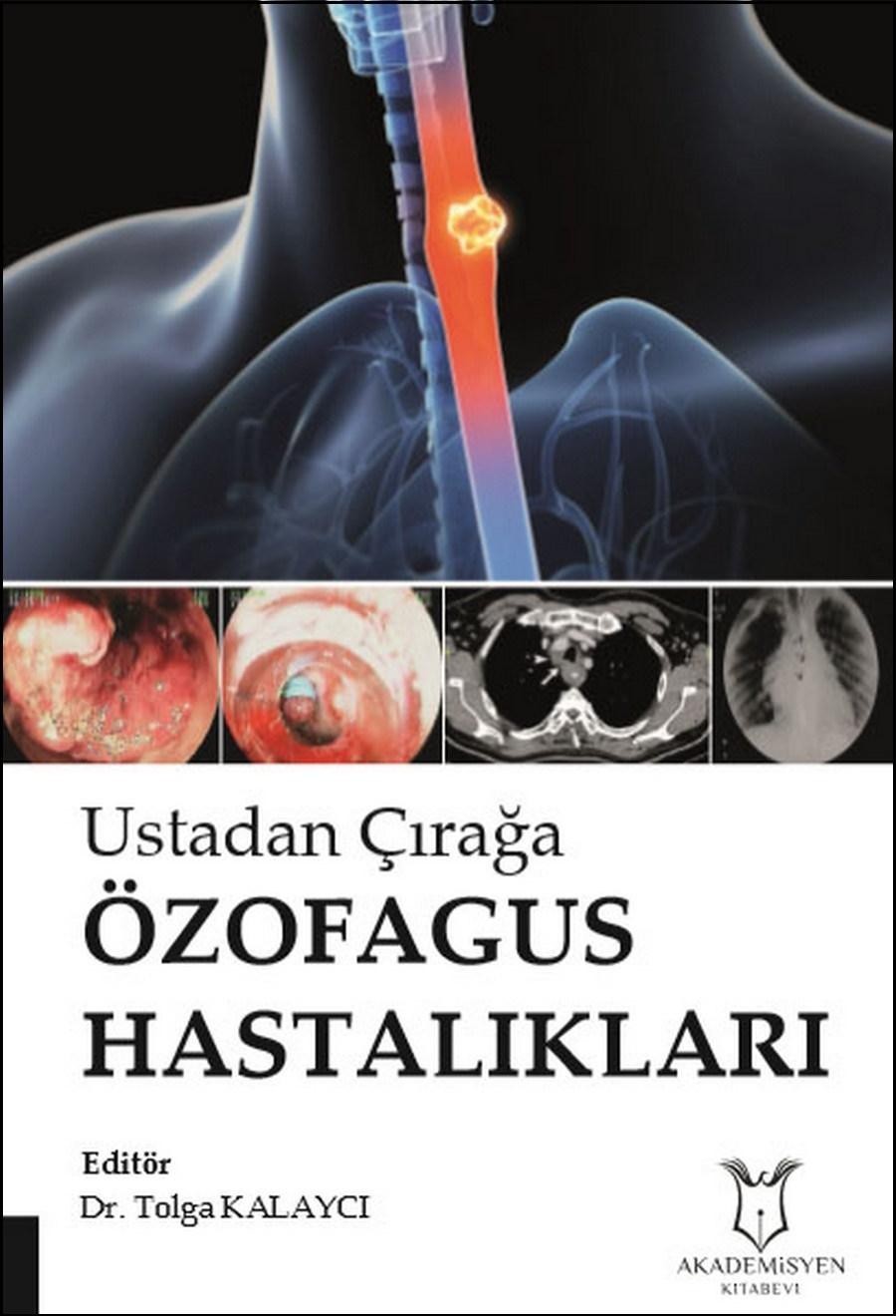 Ustadan Çırağa Özofagus Hastalıkları