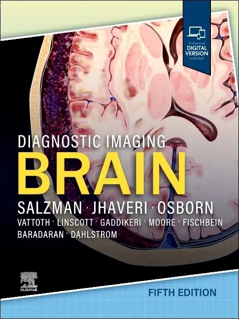 健康・医学 DIAGNOSTIC IMAGING BRAIN Diagnostic Imaging Brain, 5th Edition
