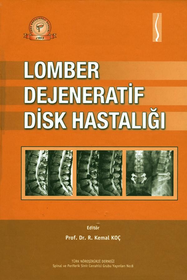 Lomber Dejeneratif Disk Hastalığı