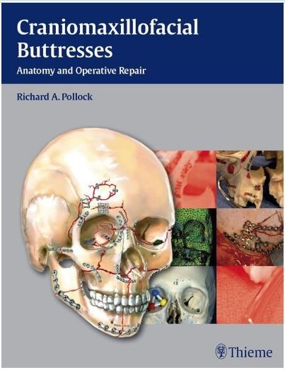 Craniomaxillofacial Buttresses: Anatomy and Operative Repair