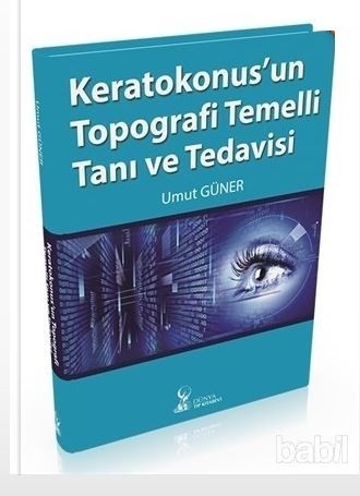 Keratokonus`un Topografi Temelli Tanı ve Tedavisi
