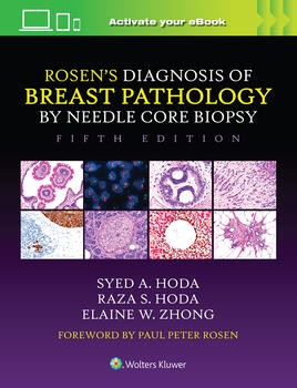 Rosen`s Diagnosis of Breast Pathology by Needle Core Biopsy