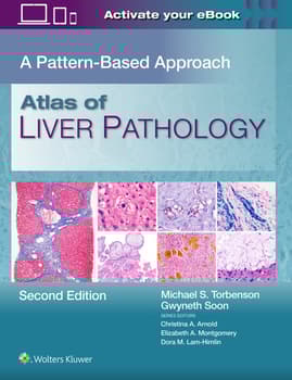Atlas of Liver Pathology: A Pattern-Based Approach, 2 Edition