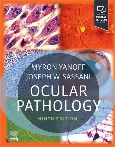 Ocular Pathology, 9th Edition