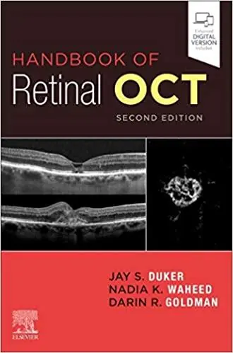 Handbook of Retinal OCT: Optical Coherence Tomography - 9780323757720