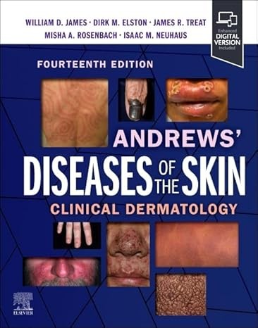 Andrews' Diseases of the Skin: Clinical Dermatology 14th Edition