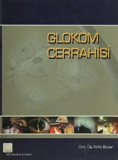 Glokom Cerrahisi