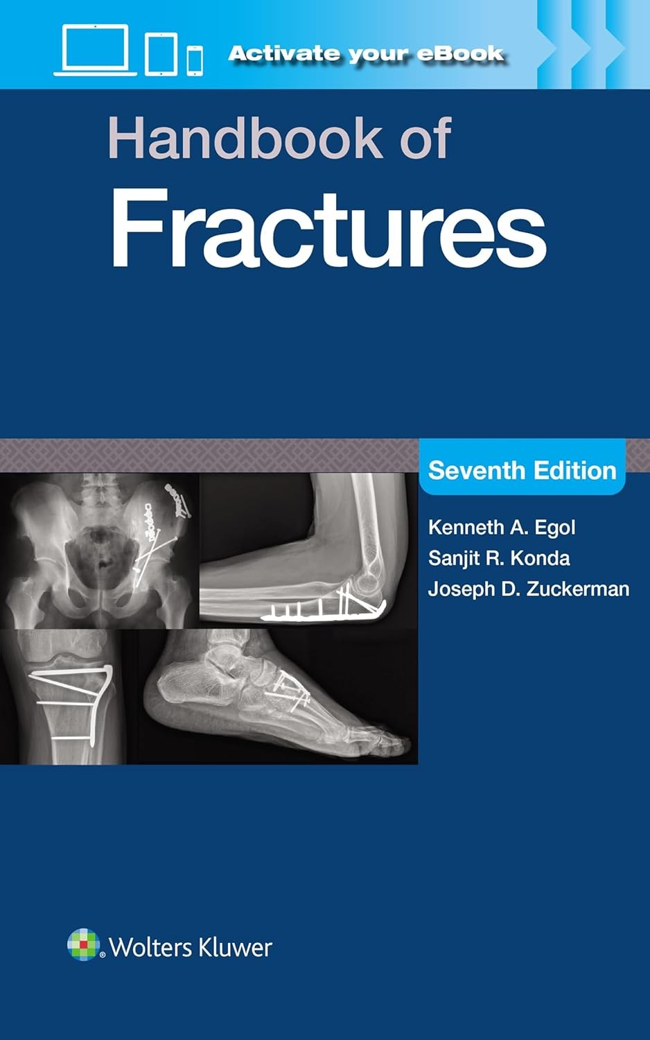 Handbook of Fractures Print + eBook with Multimedia,7 Edition