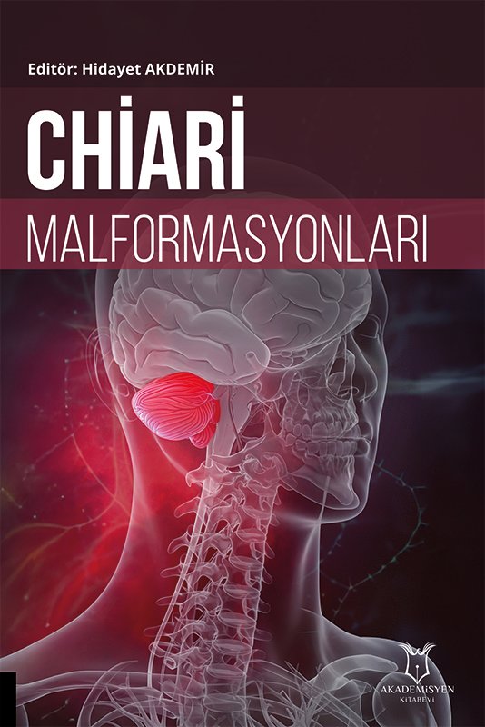 Chiari Malformasyonları