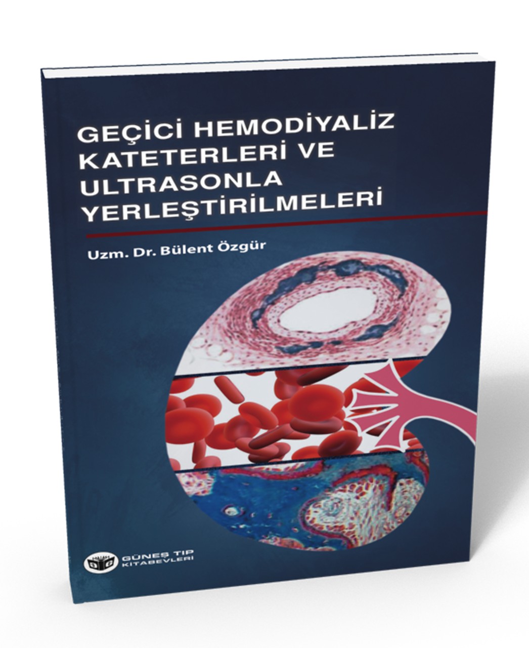 Geçici Hemodiyaliz Kateterleri ve Ultrasonla Yerleştirilmeleri
