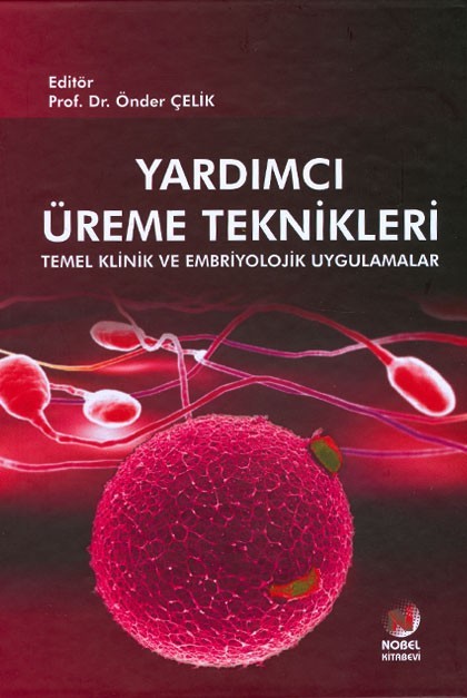 Yardımcı Üreme Teknikleri