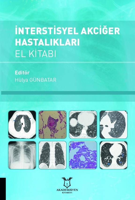 İnterstisyel Akciğer Hastalıkları El Kitabı