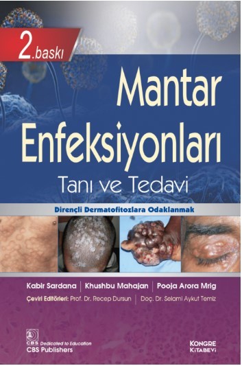 Mantar Enfeksiyonları Tanı ve Tedavi