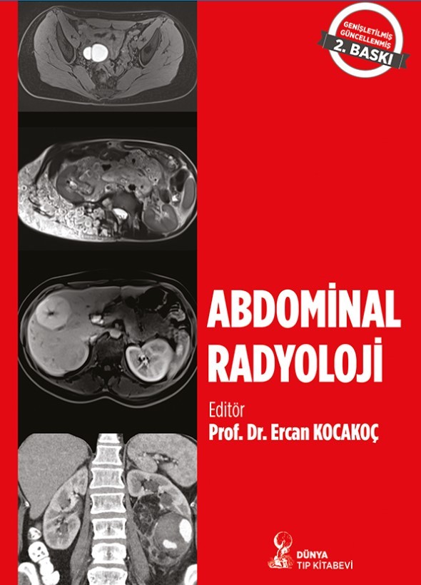 Abdominal Radyoloji 2. Baskı