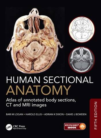 Human Sectional Anatomy Atlas of annotated body sections, CT and MRI ...
