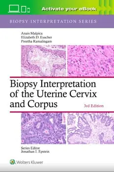 Biopsy Interpretation of the Uterine Cervix and Corpus: Print + eBook ...